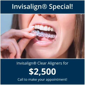 Clear aligners Special
